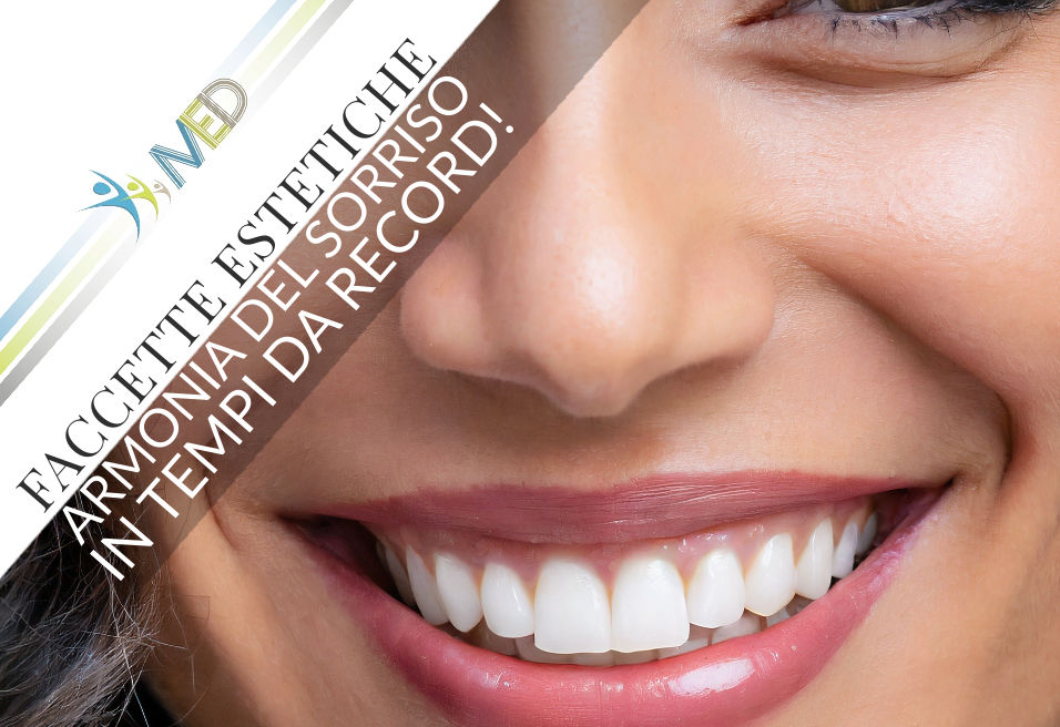 Faccette estetiche: un sorriso luminoso e armonioso in pochi passi!